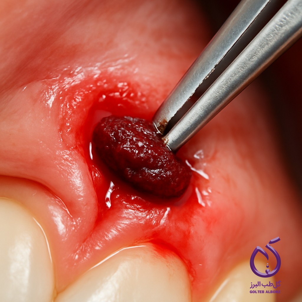 Everything You Need to Know About Dental Hemostats (2025)